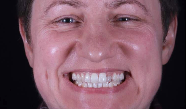 Before - Dr Nina Shaffie