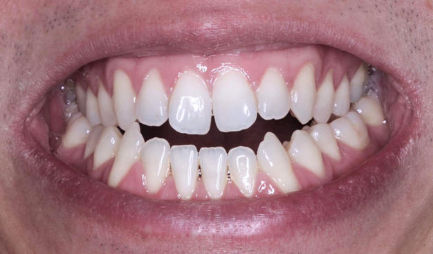 Before - Dr Nina Shaffie