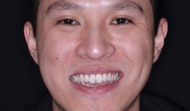 Before - Dr Nina Shaffie