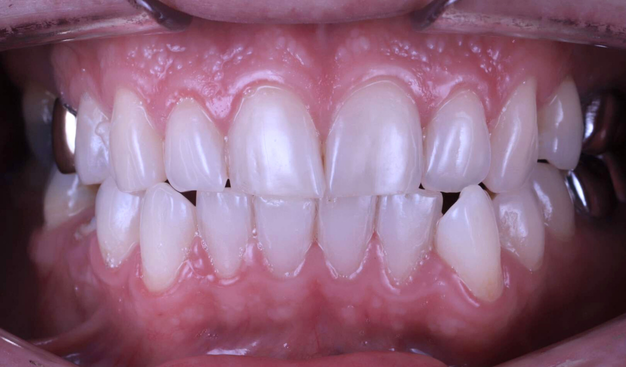 Before - Dr Nina Shaffie