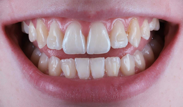 Before - Dr Nina Shaffie