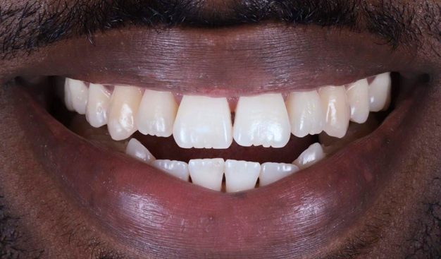 Before - Dr Nina Shaffie