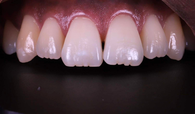 Before - Dr Nina Shaffie