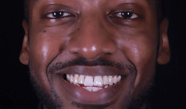 Before - Dr Nina Shaffie