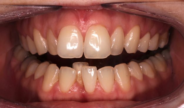 Before - Dr Nina Shaffie