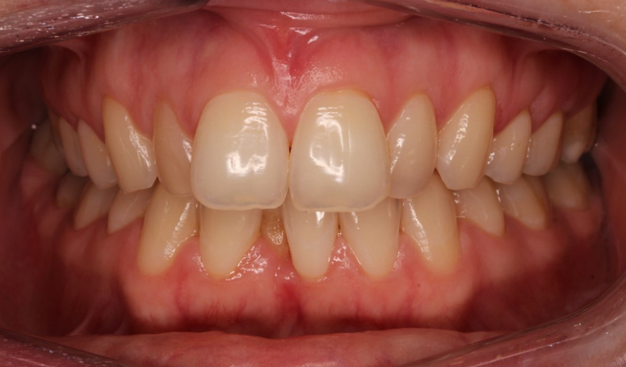 Before - Dr Nina Shaffie