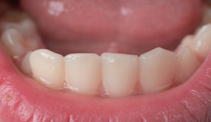 Treatment -  Dr Nina Shaffie