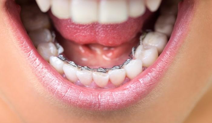 Treatment -  Dr Nina Shaffie