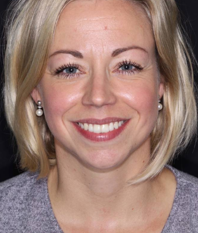 face - Dr Nina Shaffie