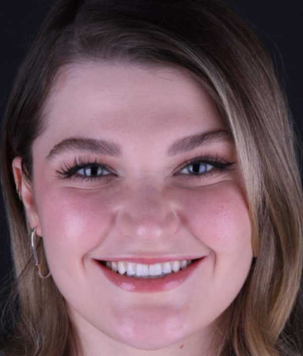 face - Dr Nina Shaffie