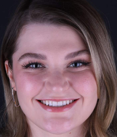 face - Dr Nina Shaffie