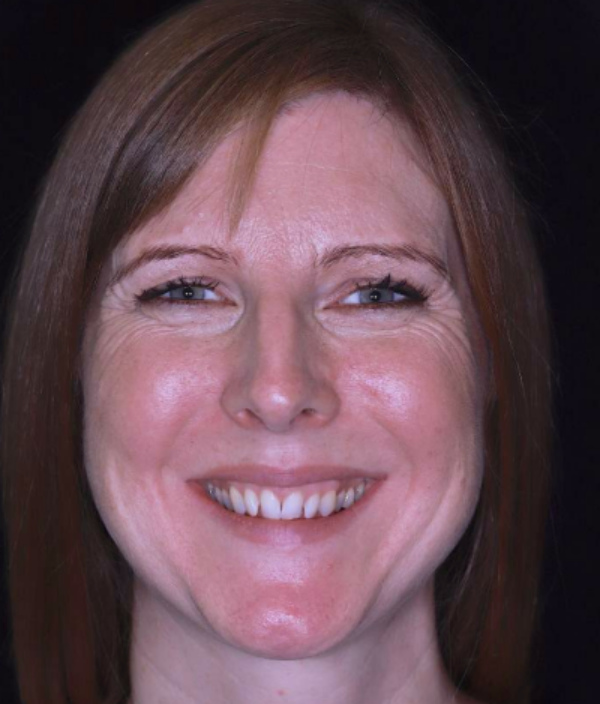 face - Dr Nina Shaffie