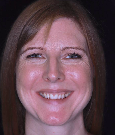 face - Dr Nina Shaffie