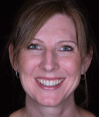 face - Dr Nina Shaffie