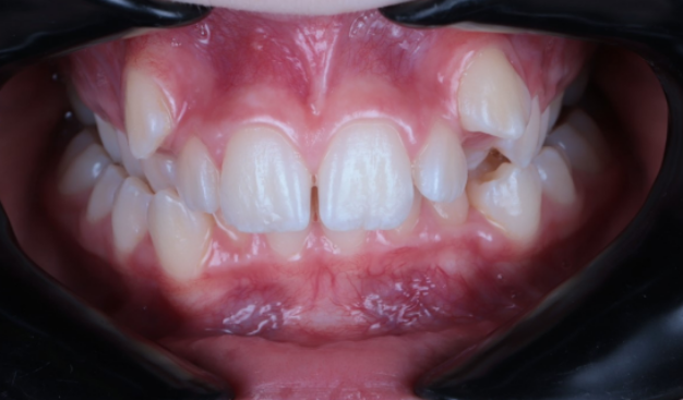 face - Dr Nina Shaffie