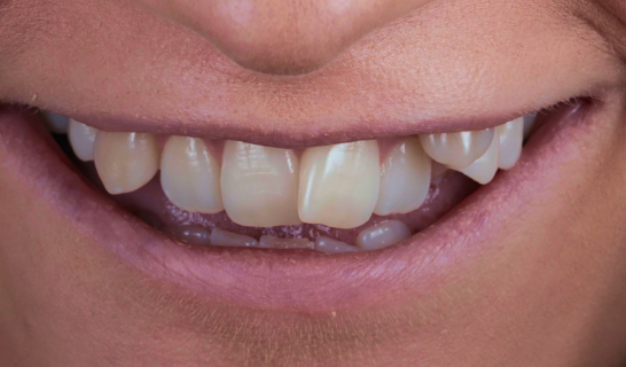 face - Dr Nina Shaffie