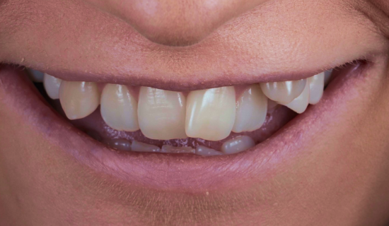 face - Dr Nina Shaffie