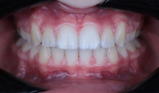 face - Dr Nina Shaffie