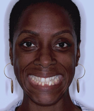 face - Dr Nina Shaffie