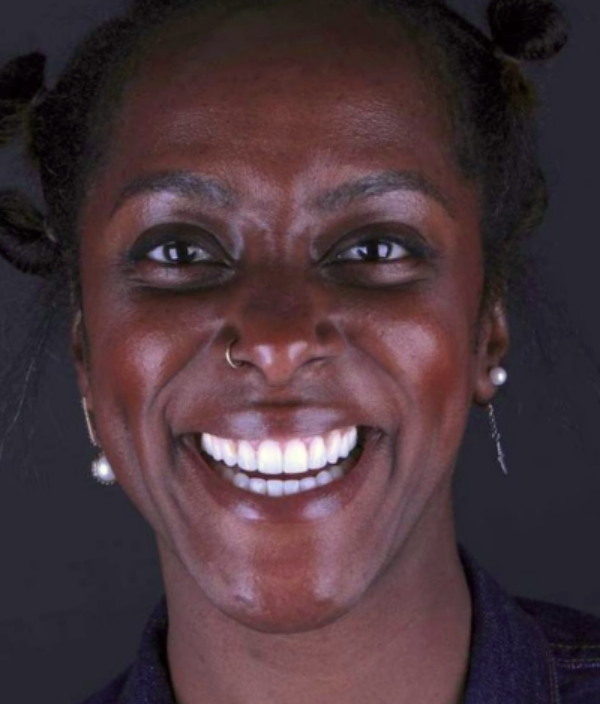 face - Dr Nina Shaffie