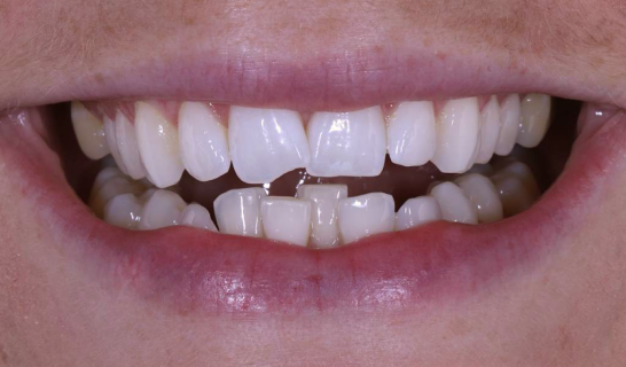 face - Dr Nina Shaffie