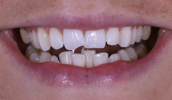 face - Dr Nina Shaffie