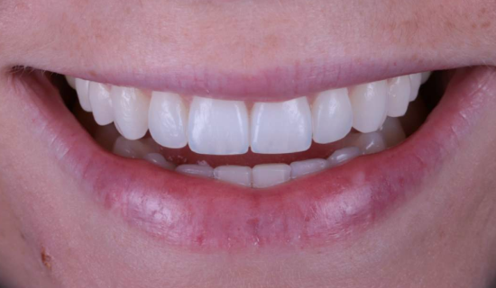 face - Dr Nina Shaffie