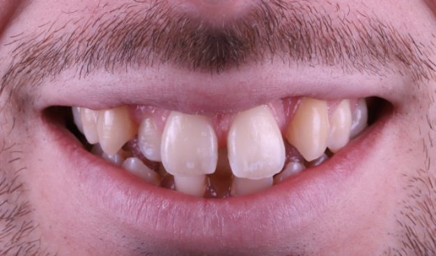 face - Dr Nina Shaffie