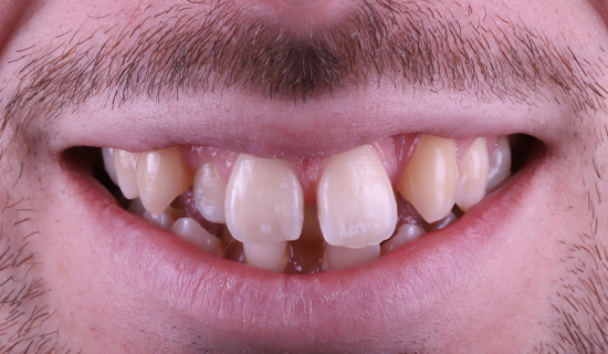 face - Dr Nina Shaffie