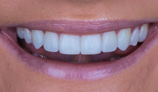 face - Dr Nina Shaffie