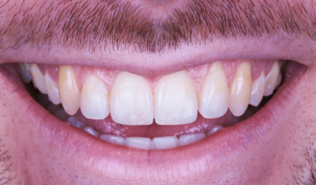 face - Dr Nina Shaffie