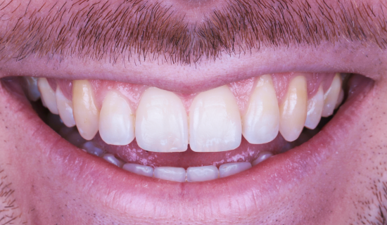 face - Dr Nina Shaffie