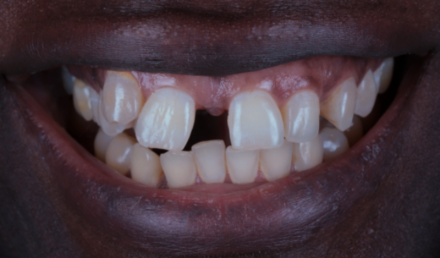 face - Dr Nina Shaffie