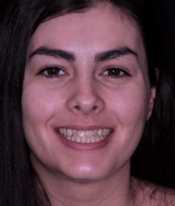 face - Dr Nina Shaffie