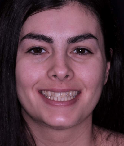 face - Dr Nina Shaffie