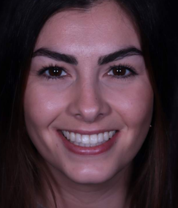 face - Dr Nina Shaffie