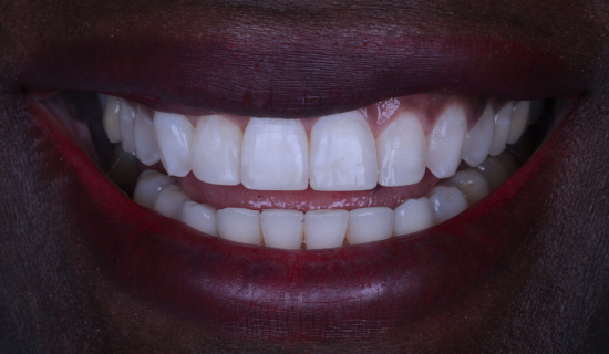 face - Dr Nina Shaffie