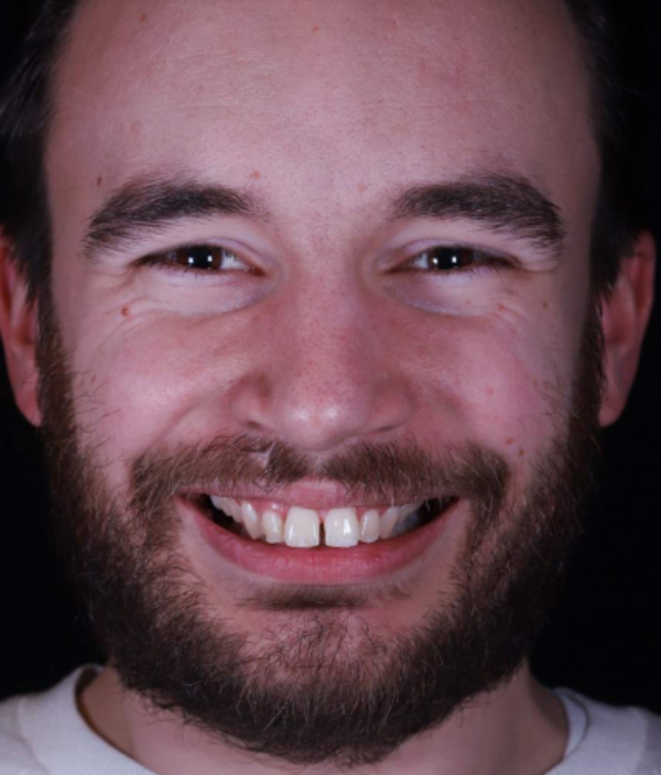 face - Dr Nina Shaffie