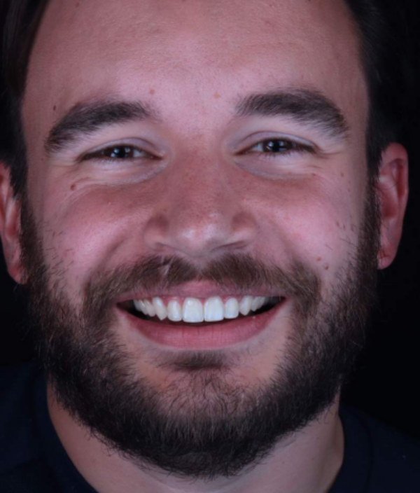 face - Dr Nina Shaffie