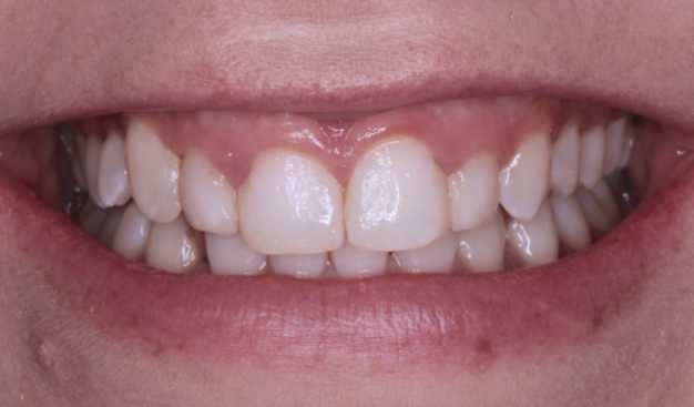 face - Dr Nina Shaffie