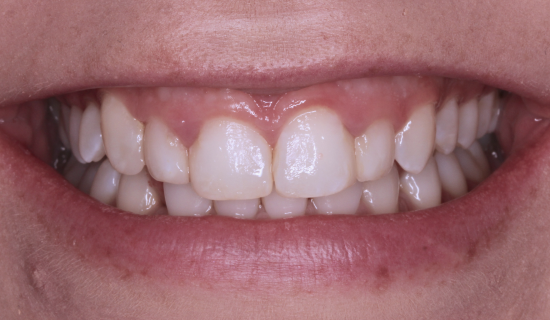 face - Dr Nina Shaffie