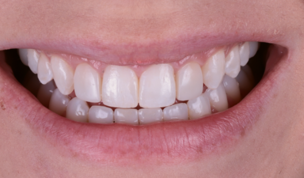 face - Dr Nina Shaffie