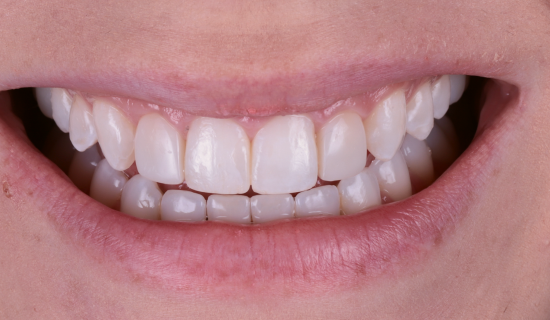 face - Dr Nina Shaffie