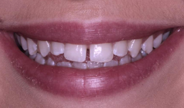 face - Dr Nina Shaffie