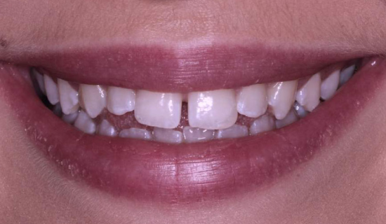 face - Dr Nina Shaffie