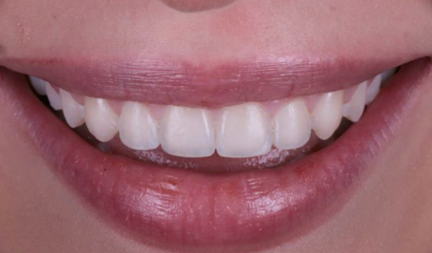 face - Dr Nina Shaffie