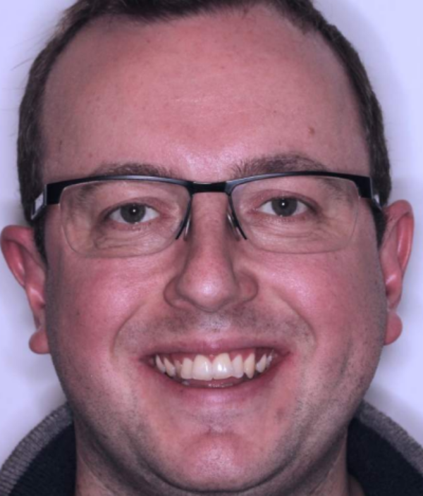 face - Dr Nina Shaffie