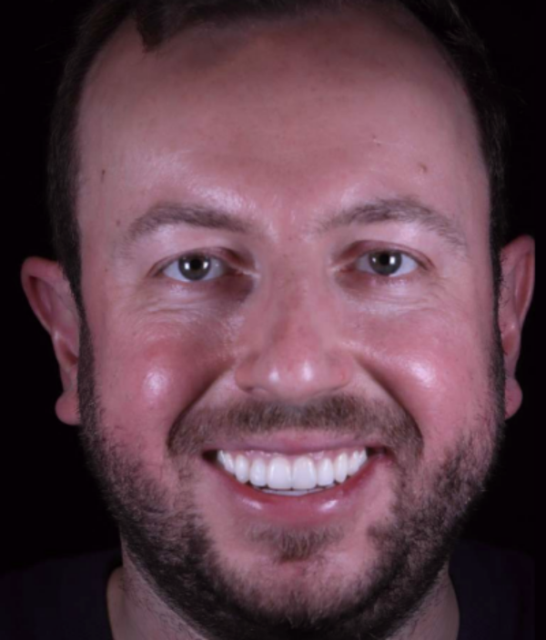 face - Dr Nina Shaffie