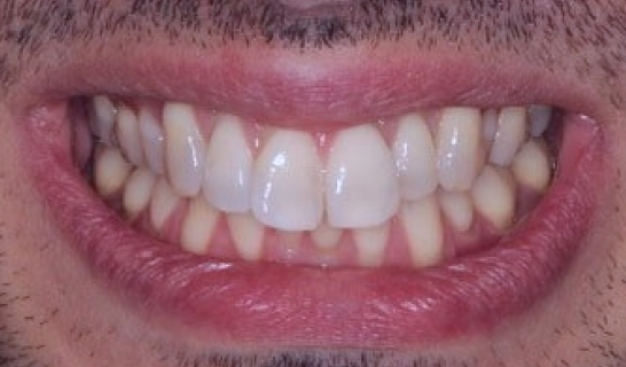 face - Dr Nina Shaffie