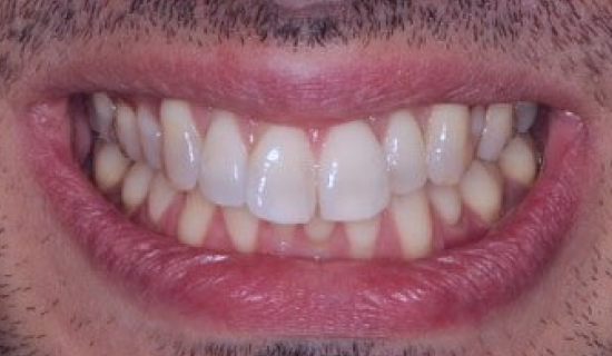 face - Dr Nina Shaffie